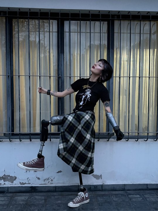 Victoria Rojo: luchando por calidad de vida en medio de la burocracia