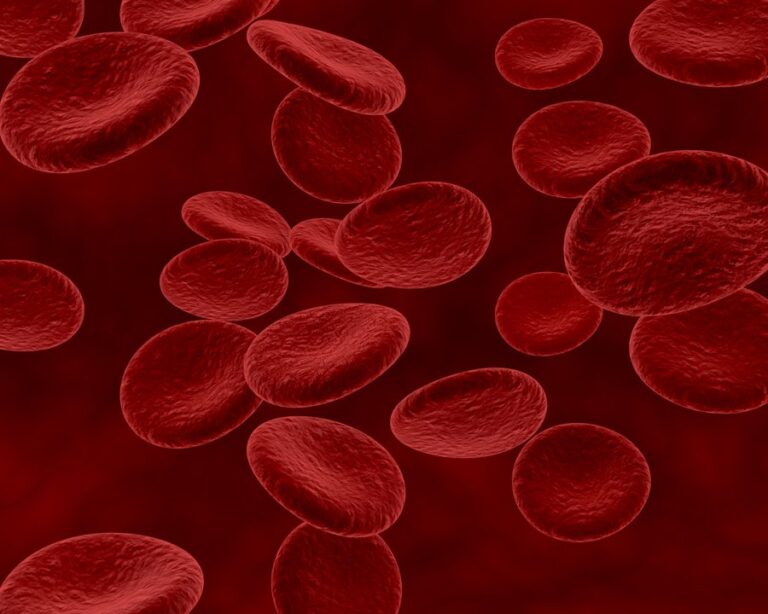 La anemia como alerta: un posible indicio de síndrome mielodisplásico