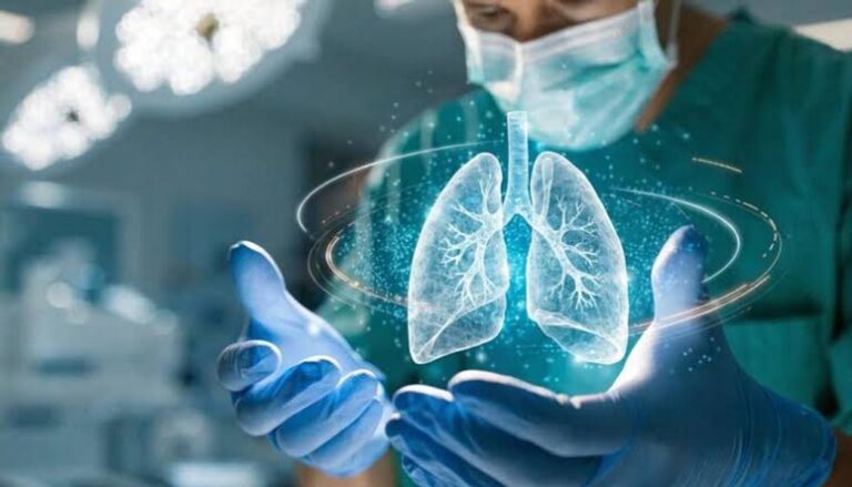 Nódulo pulmonar: claves para identificar si es benigno o maligno